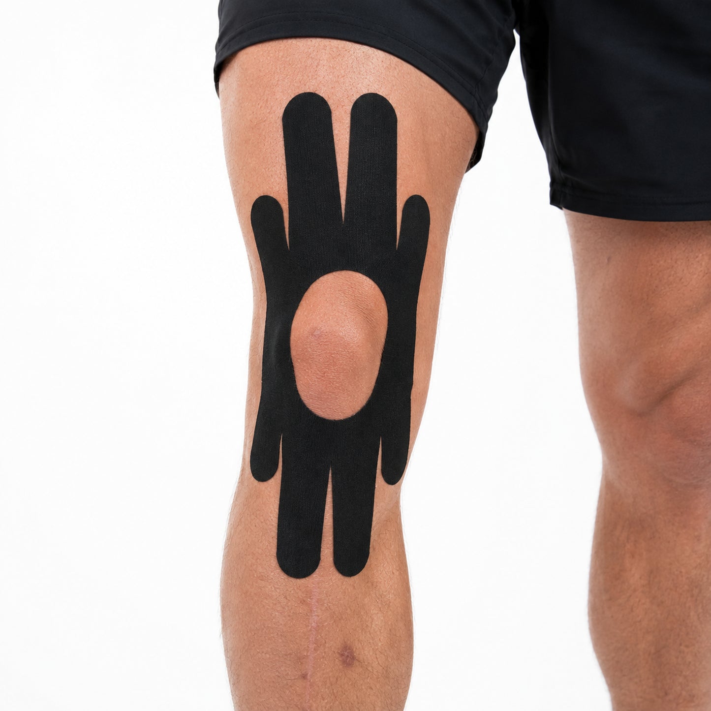 Förklippt kinesiologitejp för knä i svart applicerad runt knäskålen för stöd vid rörelse och aktivitet.