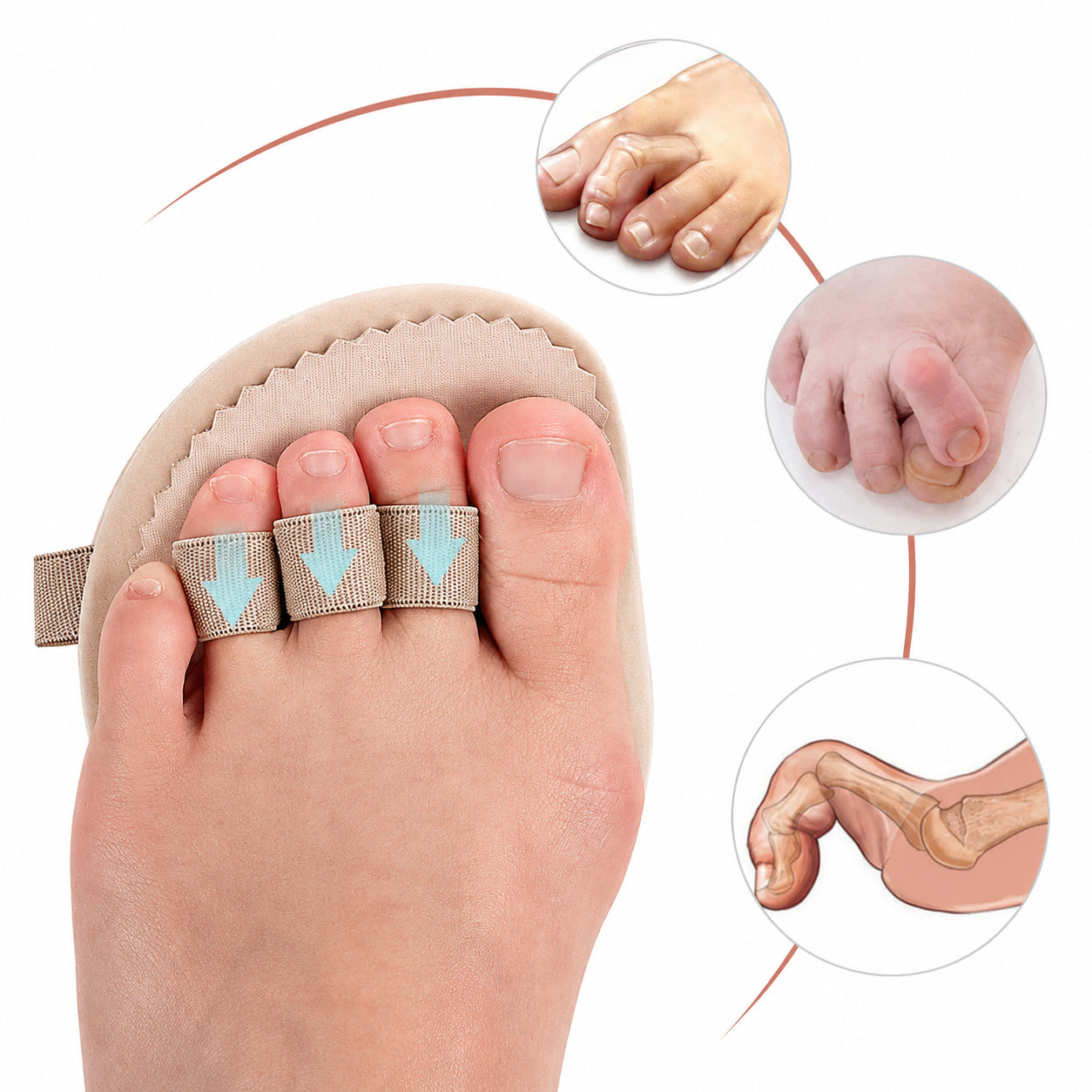 Soutien pour orteil en marteau avec boucles élastiques et coussinet doux qui aident à redresser les orteils recourbés, apportent un soutien et soulagent l'avant-pied.