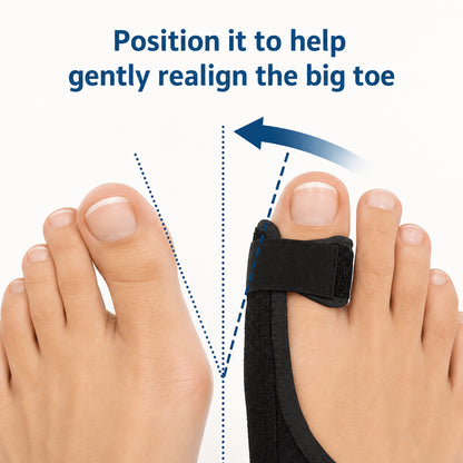 Infographie montrant comment une attelle de nuit pour hallux valgus aide à redresser le gros orteil vers une position plus naturelle pour plus de soutien et de soulagement.