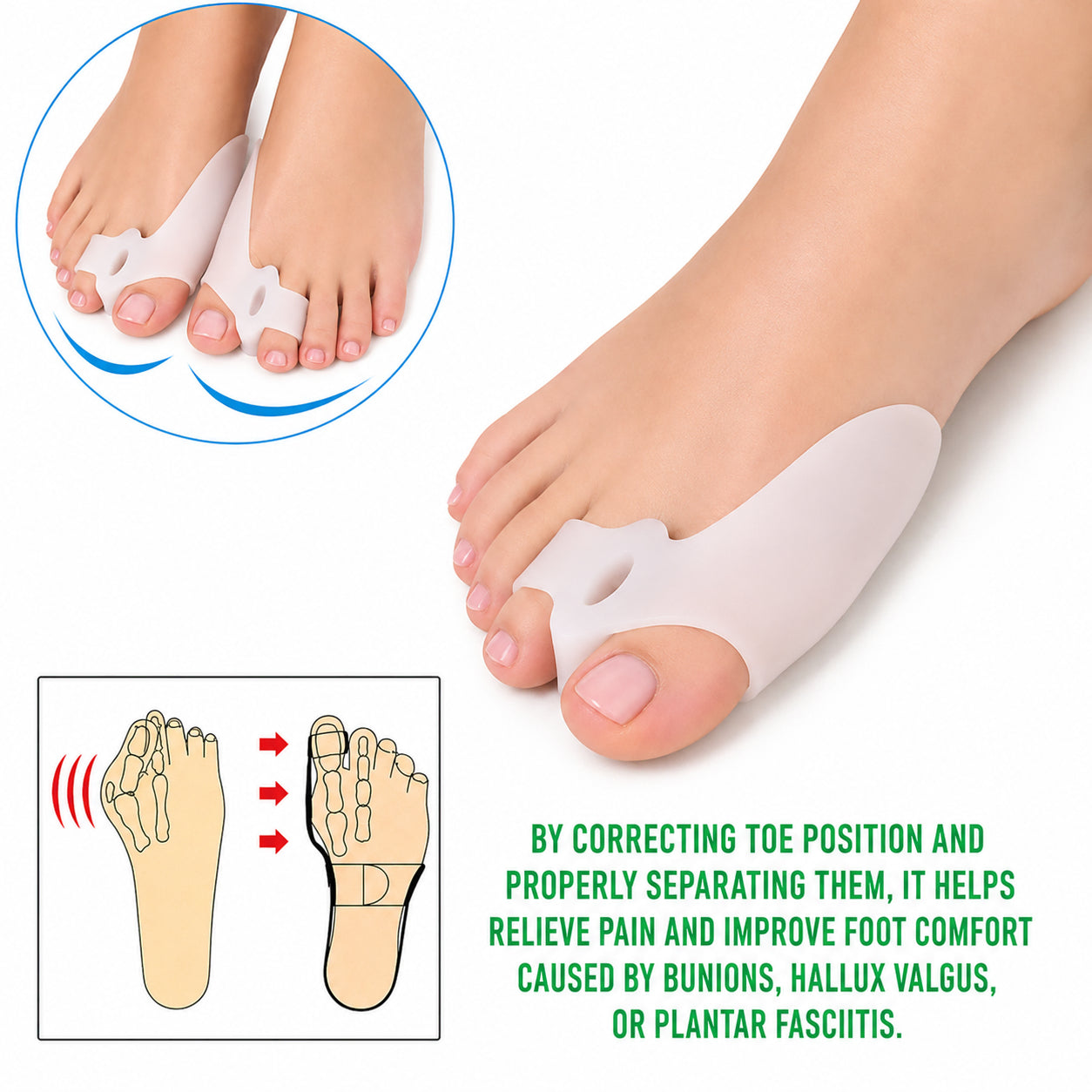 Protection pour hallux valgus en silicone doux qui sépare le gros orteil, protège l'articulation du gros orteil et aide à réduire la pression et les frottements au quotidien.